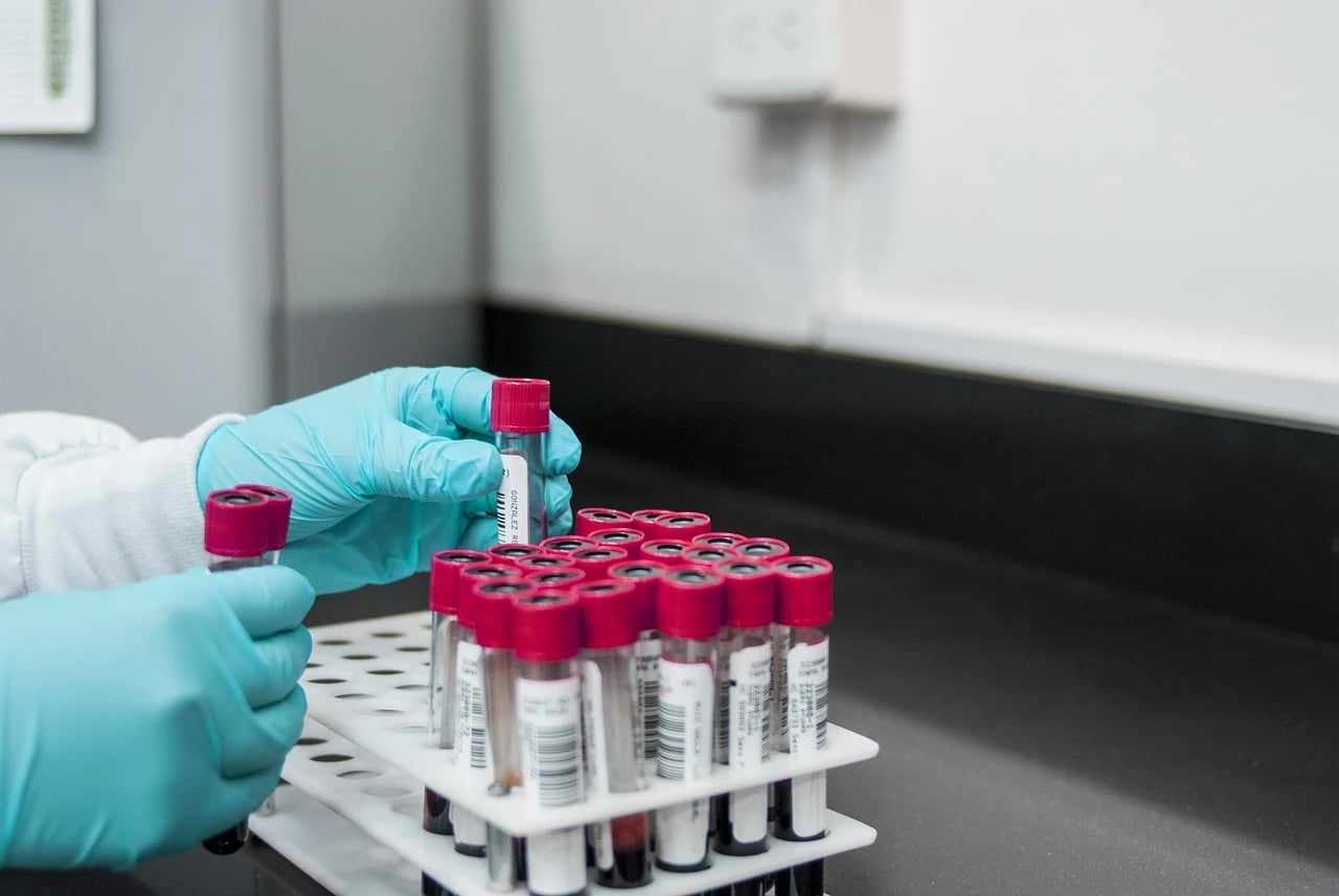 Gloved hands handle blood sample tubes with red caps in a rack on a laboratory counter